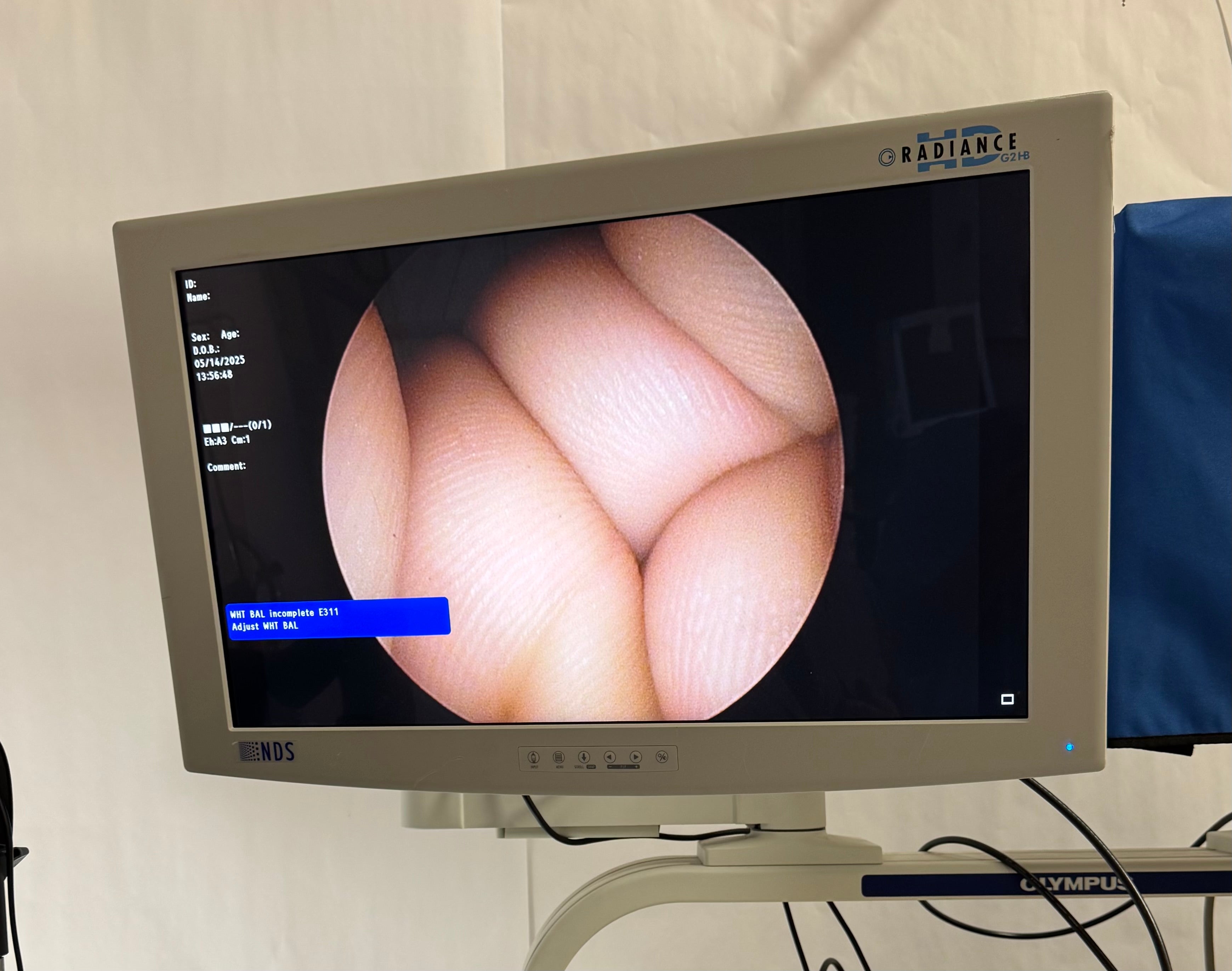 Olympus CH-S190-08-LB | HD Pendulum Light Weight Camera Head Urology