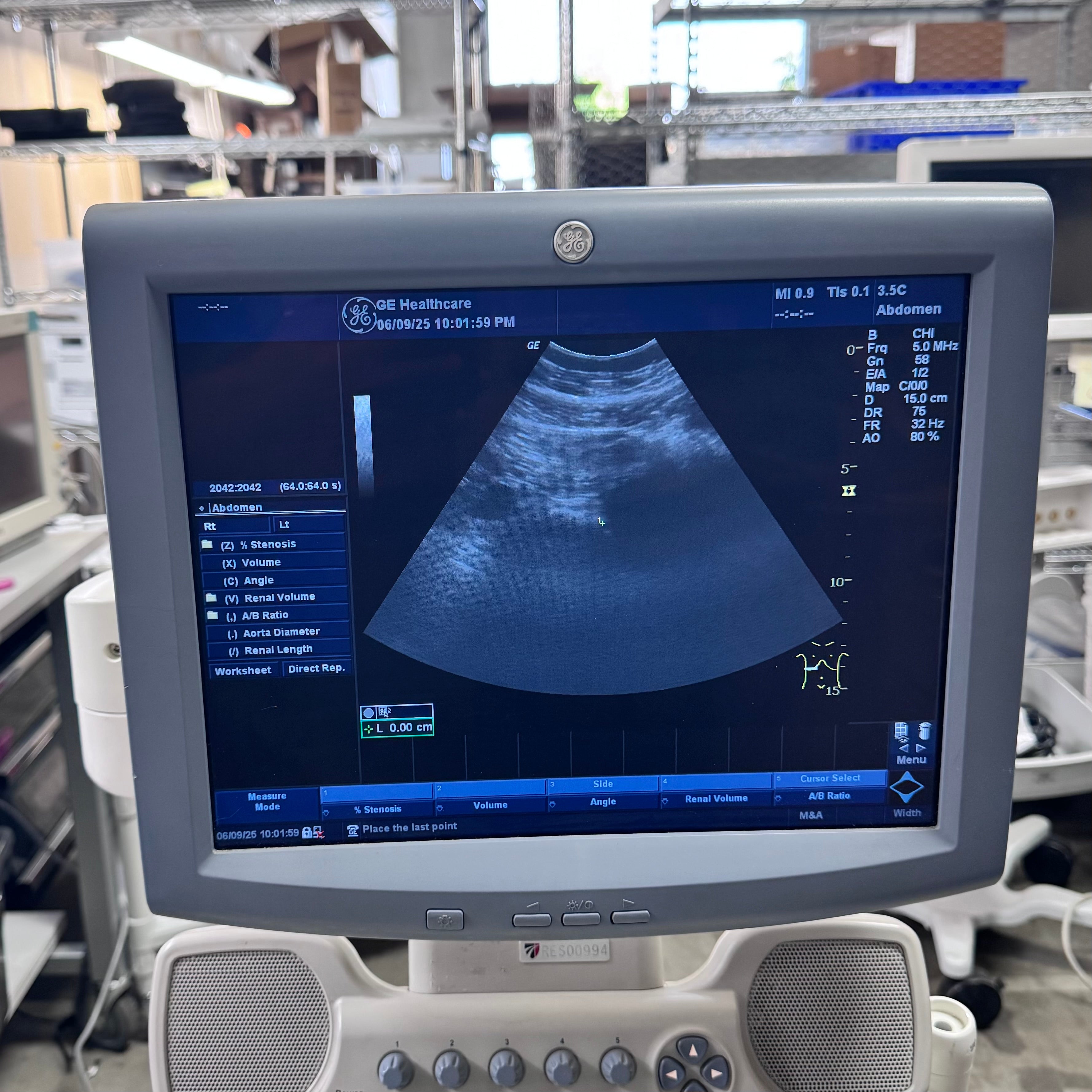 GE Healthcare 5266264 | LOGIQ P5 Ultrasound System and 1 Transducer 3.5C