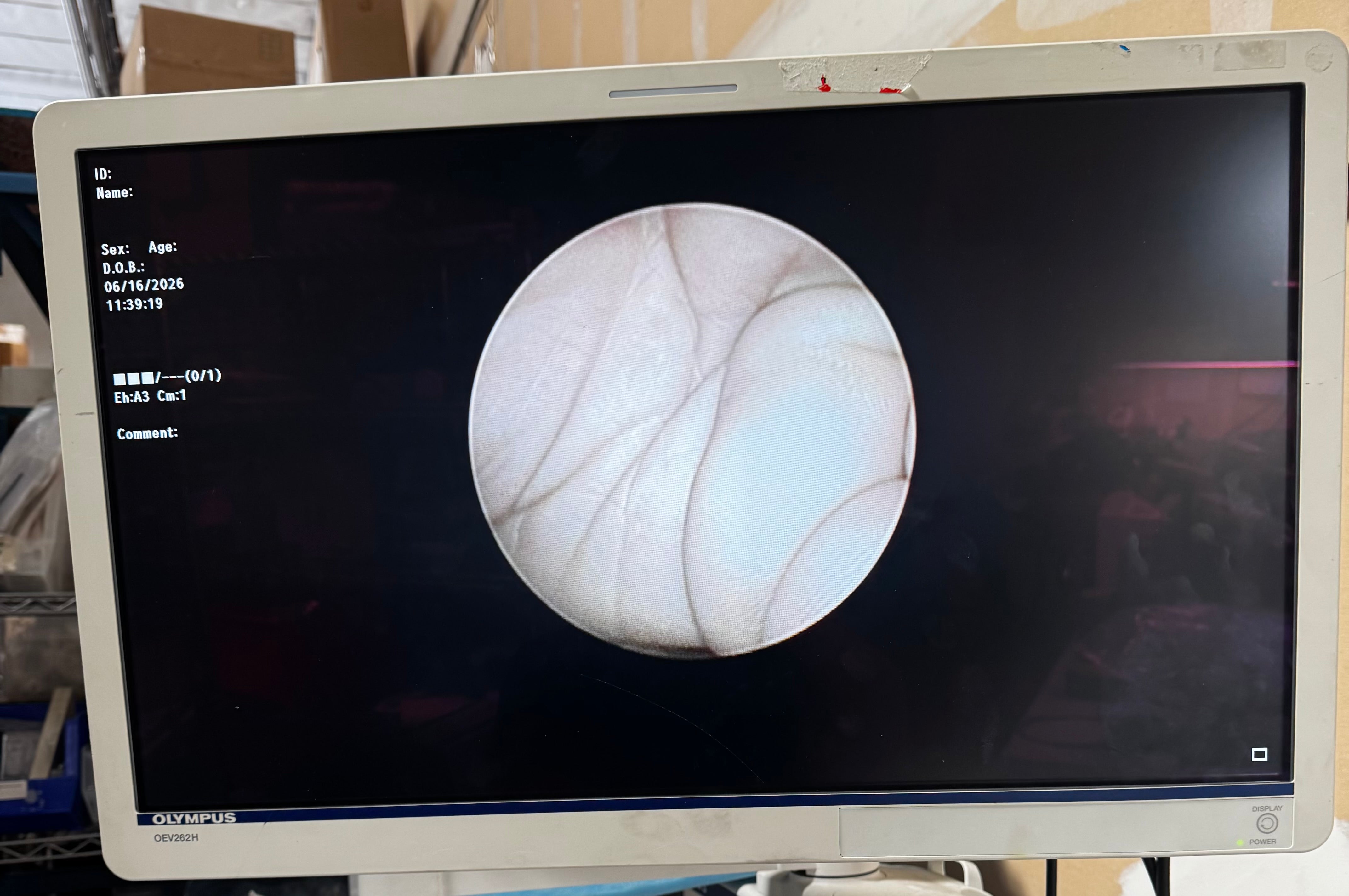Hologic MyoSure 50-200XL | XL 4mm Channel Hysteroscope for Fibroid & Polyp Removal