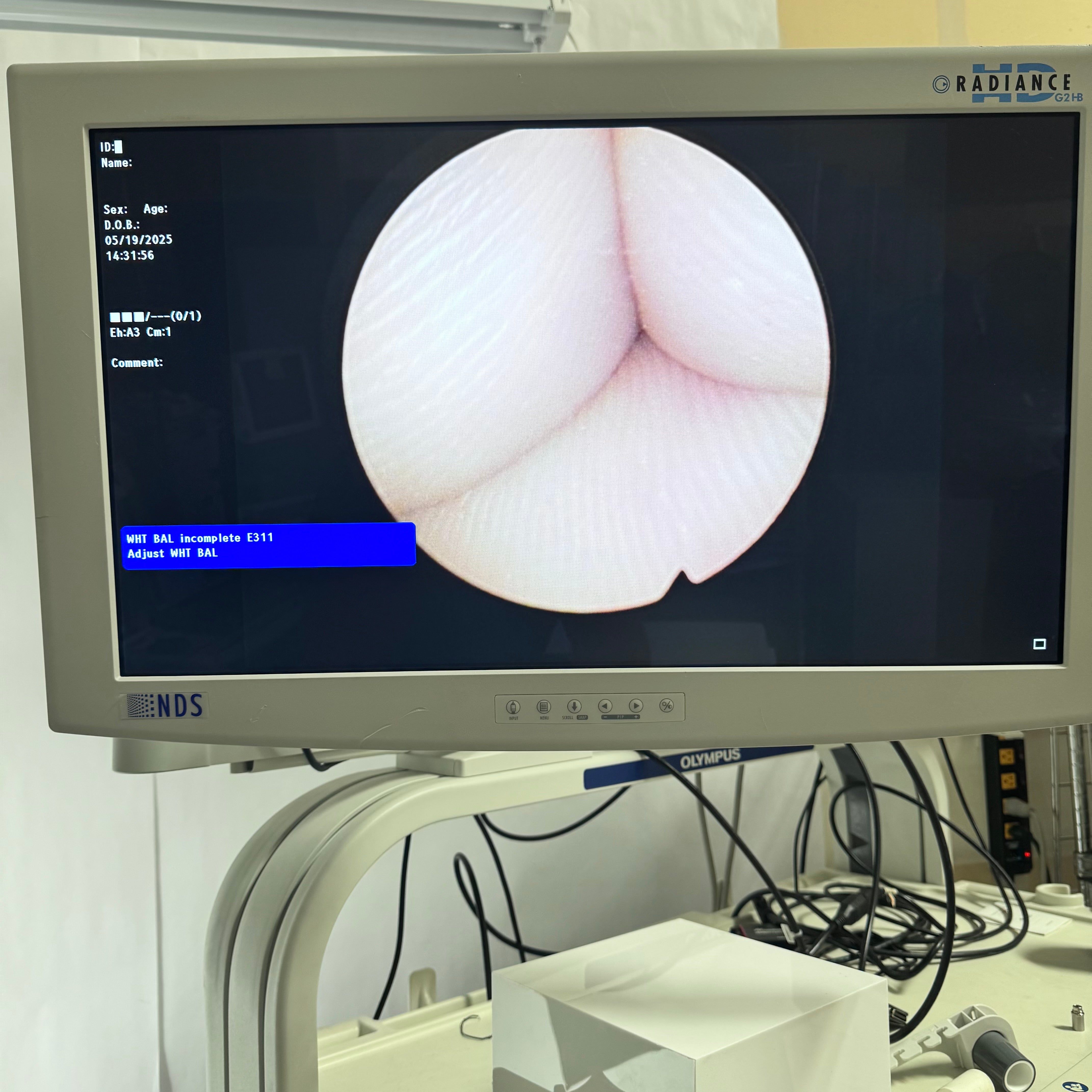 Olympus A22001A | 4mm 12 Degree Cystoscope Endoscope Telescope Urology