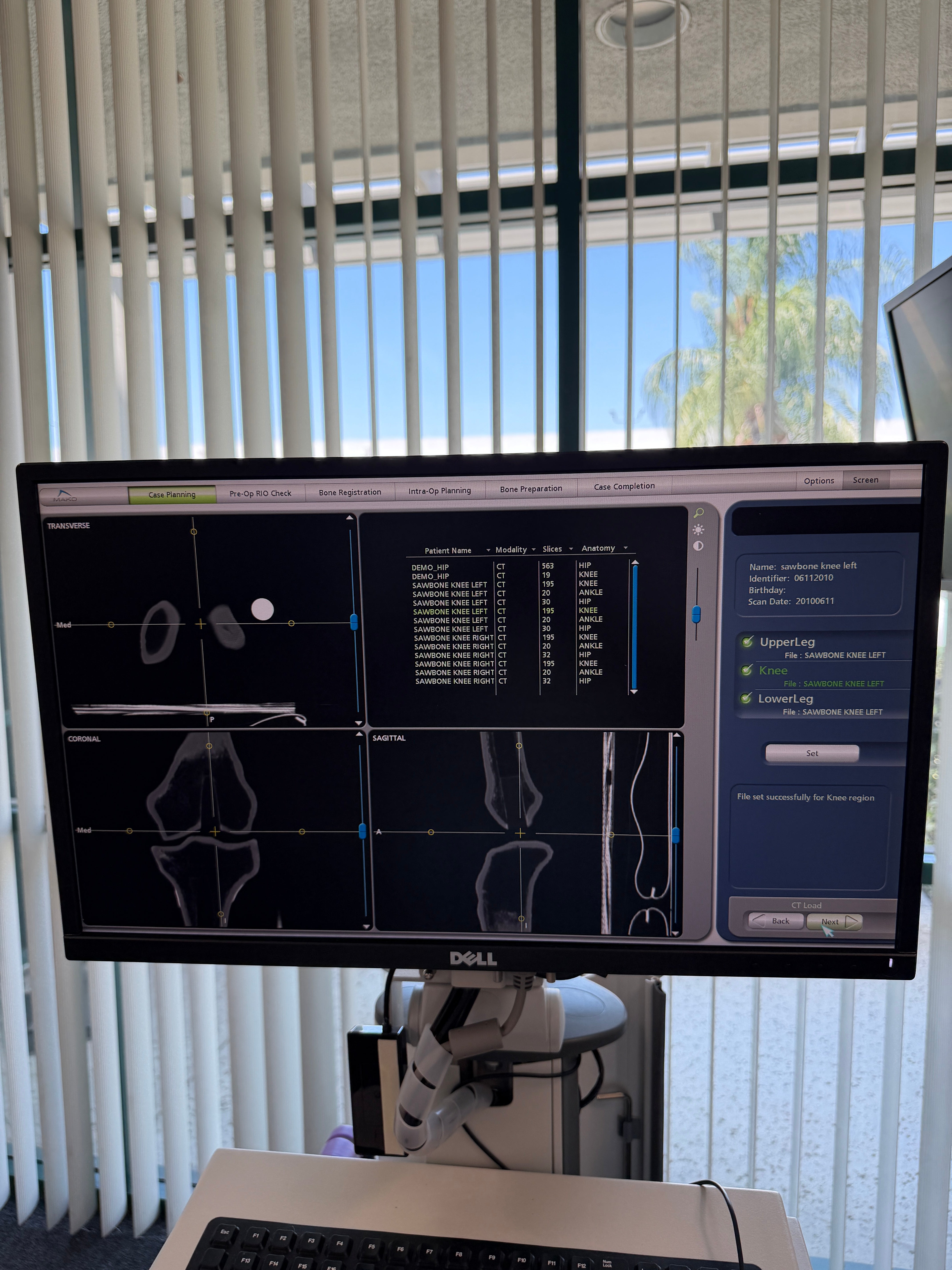 Stryker Mako Complete Program Bundle | Robot + TKA, THA & PKA Instrument Sets